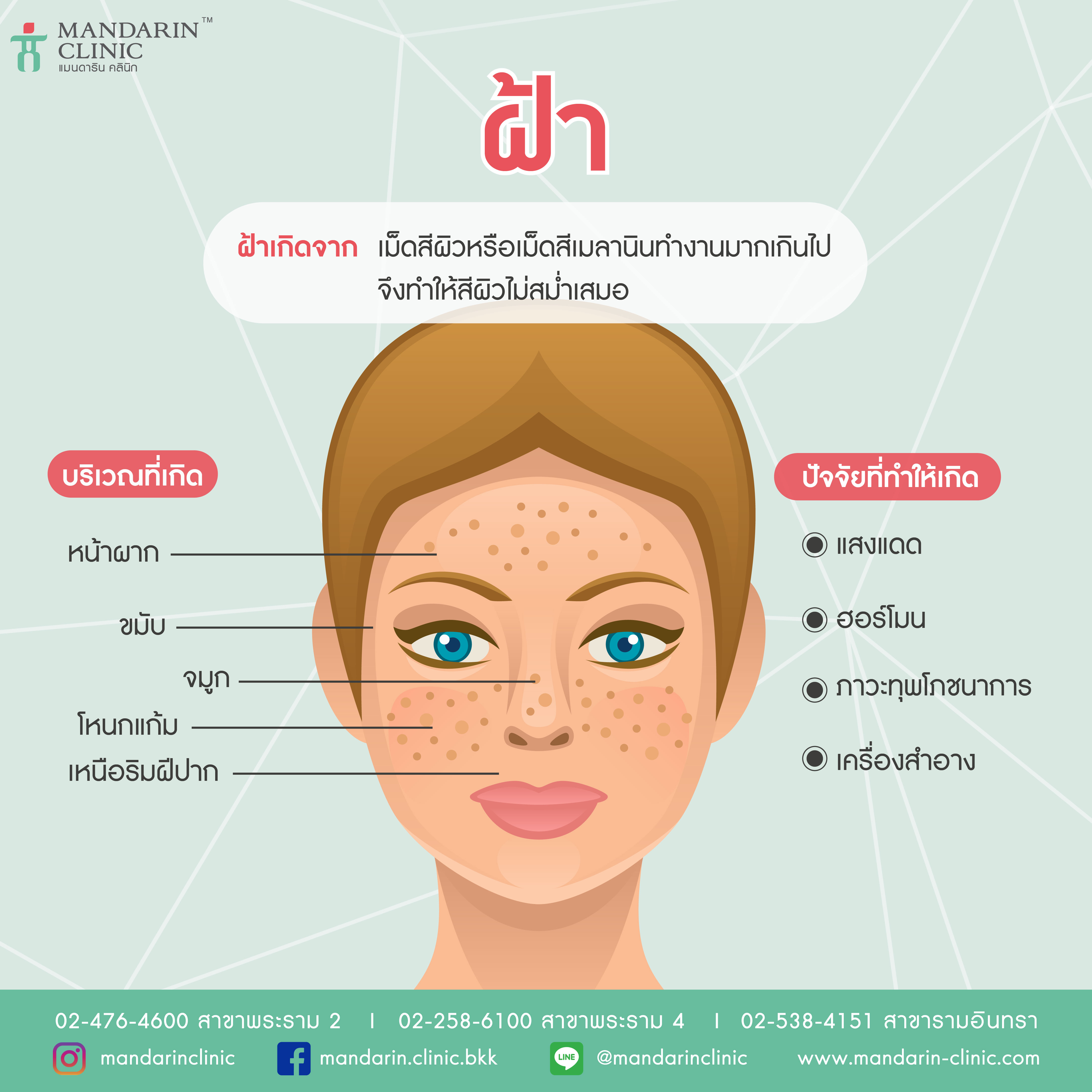 ฝ้าเกิดจากอะไร